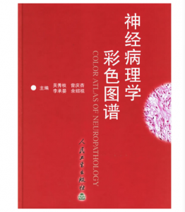 《神经病理学彩色图谱》吴秀枝主编 扫描版.PDF电子书下载-小燕分享网