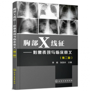 《胸部X线征 影像表现与临床意义》第2版_李羲主编.PDF电子书下载-小燕分享网